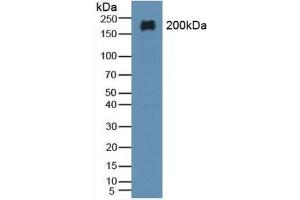 Detection of MAP2 in Rat Brain Tissue using Polyclonal Antibody to Microtubule Associated Protein 2 (MAP2) (MAP2 抗体  (AA 727-985))