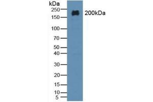 Detection of MAP2 in Rat Brain Tissue using Polyclonal Antibody to Microtubule Associated Protein 2 (MAP2) (MAP2 抗体  (AA 727-985))