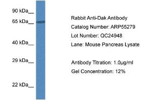 Western Blotting (WB) image for anti-Dihydroxyacetone Kinase 2 Homolog (DAK) (N-Term) antibody (ABIN2786123) (DAK 抗体  (N-Term))