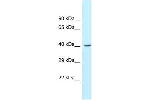 WB Suggested Anti-Gcat Antibody   Titration: 1. (GCAT 抗体  (C-Term))