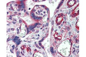 Immunohistochemistry (IHC) image for anti-Multiple C2 Domains, Transmembrane 1 (MCTP1) (Middle Region) antibody (ABIN2781866) (MCTP1 抗体  (Middle Region))