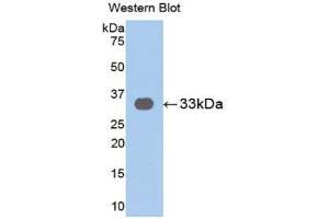 Western Blotting (WB) image for anti-Interleukin 31 Receptor A (IL31RA) (AA 205-456) antibody (ABIN1859419) (IL31RA 抗体  (AA 205-456))