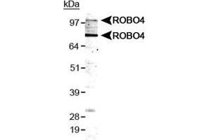 Western blot analysis of ROBO4 in HUVEC cell lysate with ROBO4 polyclonal antibody . (ROBO4 抗体  (AA 200-300))