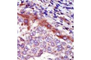 Image no. 2 for anti-Hormonally Up-Regulated Neu-Associated Kinase (HUNK) (C-Term) antibody (ABIN360358) (HUNK 抗体  (C-Term))