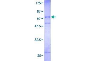 Image no. 1 for Ring Finger Protein 34 (RNF34) (AA 1-372) protein (GST tag) (ABIN1318374)