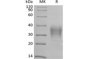 Western Blotting (WB) image for CD79b Molecule, Immunoglobulin-Associated beta (CD79B) protein (Biotin,His-Avi Tag) (ABIN7319845) (CD79b Protein (Biotin,His-Avi Tag))