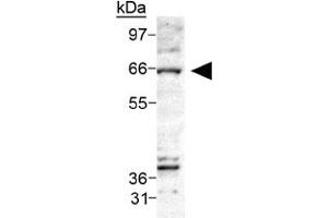 Western blot analysis of CERK on Ceramide Kinase in A-549 cell lysate using CERK polyclonal antibody . (CERK 抗体  (AA 50-150))