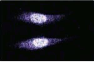 Immunofluorescence staining of human endothelial cells. (MAD2L2 抗体  (AA 81-180))