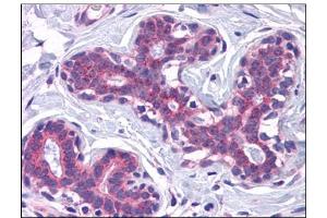 Human Breast: Formalin-Fixed, Paraffin-Embedded (FFPE) (SCAMP4 抗体  (C-Term))
