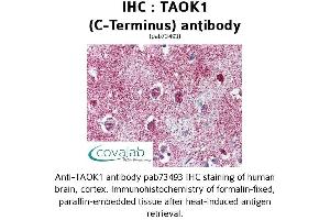 Image no. 1 for anti-TAO Kinase 1 (TAOK1) (C-Term) antibody (ABIN1739898) (TAO Kinase 1 (TAOK1) (C-Term) 抗体)