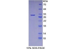 SDS-PAGE analysis of Human CAD Protein. (DFFB 蛋白)