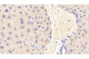 Detection of CORT in Mouse Liver Tissue using Polyclonal Antibody to Carnitine-O-Octanoyltransferase (CORT) (CROT 抗体  (AA 410-612))