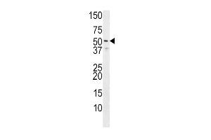 Western blot analysis of anti-HH3R Pab (Rabbit ID 1071) in Jurkat cell line lysate (35 μg/lane). (HRH3 抗体  (C-Term))