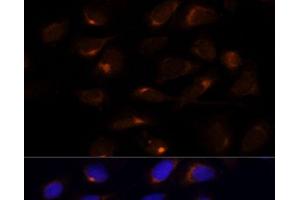 Immunofluorescence analysis of U-2 OS cells using SCD Polyclonal Antibody at dilution of 1:100 (40x lens). (SCD 抗体)