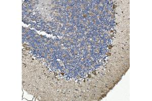 IHC analysis of non-muscle Myosin IIB/MYH10 using anti-non-muscle Myosin IIB/MYH10 antibody (ABIN7603186). (MYH10 抗体  (N-Term))