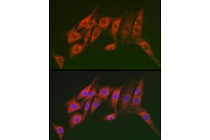 Immunofluorescence analysis of NIH/3T3 cells using MTMR14 Rabbit pAb (ABIN6129695, ABIN6144154, ABIN6144155 and ABIN6223372) at dilution of 1:100 (40x lens). (MTMR14 抗体  (AA 1-280))