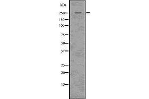 Western blot analysis Aggrecan using 293 whole cell lysates. (Aggrecan 抗体)