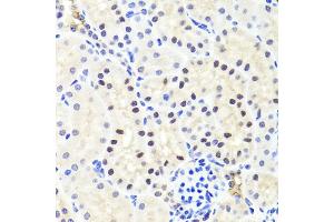 Immunohistochemistry of paraffin-embedded mouse kidney using RUNX1 antibody (ABIN6291786) at dilution of 1:100 (40x lens).