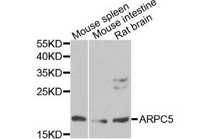 Western blot analysis of extracts of various cell lines, using ARPC5 antibody. (ARPC5 抗体)