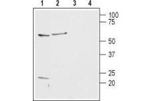 Western blot analysis of rat basophilic leukemia cells (RBL) (lanes 1 and 3) and rat brain lysates (lanes 2 and 4): - 1,2. (HRH2 抗体  (2nd Extracellular Loop))