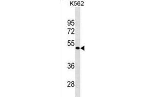 Western Blotting (WB) image for anti-G Protein-Coupled Receptor 39 (GPR39) antibody (ABIN3000707) (GPR39 抗体)