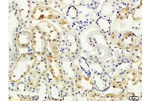 Formalin-fixed and paraffin embedded rat kidney labeled with Anti- NCX2/SLC8A2 Polyclonal Antibody, Unconjugated (ABIN676478) at 1:200 followed by conjugation to the secondary antibody and DAB staining (SLC8A2 抗体  (AA 601-700))