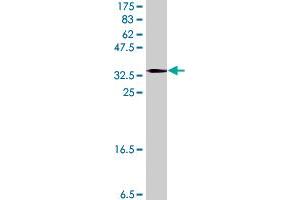Western Blotting (WB) image for anti-Cytochrome P450, Family 24, Subfamily A, Polypeptide 1 (CYP24A1) (AA 415-514) antibody (ABIN560551)