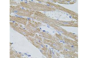 Immunohistochemistry (Paraffin-embedded Sections) (IHC (p)) image for anti-Transient Receptor Potential Cation Channel, Subfamily A, Member 1 (TRPA1) antibody (ABIN7264621)