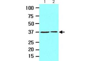 Cell lysates of HeLa (lane 1) and 293T (lane 2) (20 ug) were resolved by SDS-PAGE and probed with EPM2A monoclonal antibody, clone k2A3  (1:1000). (EPM2A 抗体  (AA 243-331))