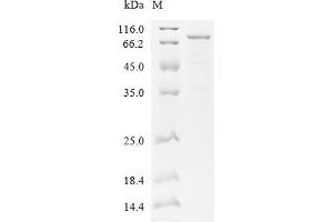 (Tris-Glycine gel) Discontinuous SDS-PAGE (reduced) with 5 % enrichment gel and 15 % separation gel.