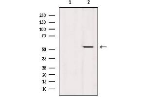 Western blot analysis of extracts from Hela, using KRT36 Antibody. (Keratin 36 抗体  (Internal Region))