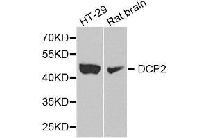 Western blot analysis of extract of HT29 and rat brain cells, using DCP2 antibody. (DCP2 抗体)