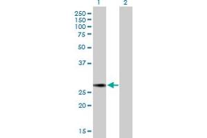 Western Blot analysis of NUSAP1 expression in transfected 293T cell line by NUSAP1 MaxPab polyclonal antibody. (NUSAP1 抗体  (AA 1-226))