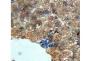 Used in DAB staining on fromalin fixed paraffin-embedded Liver tissue (Growth Hormone 1 抗体  (AA 28-216))