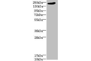 Western blot All lanes: LRP4 antibody at 1. (LRP4 抗体  (AA 1500-1725))