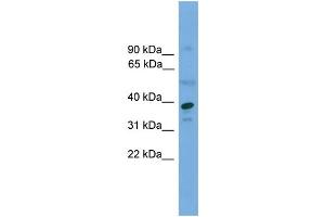 WB Suggested Anti-APEX1  Antibody Titration: 0. (APEX1 抗体  (Middle Region))