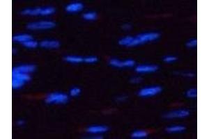 Immunofluorescence analysis of Rat heart tissue using Phospho-AMPK alpha1/2 (Thr183/172) Polyclonal Antibody at dilution of 1:200 (PRKAA1/PRKAA2 抗体  (pThr172, pThr183))