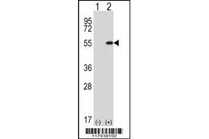 Western blot analysis of DDX39 using rabbit polyclonal using 293 cell lysates (2 ug/lane) either nontransfected (Lane 1) or transiently transfected (Lane 2) with the DDX39 gene. (DDX39 抗体  (AA 250-277))