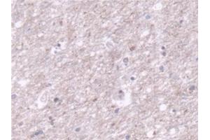 Detection of TOMM70A in Human Cerebrum Tissue using Polyclonal Antibody to Translocase Of Outer Mitochondrial Membrane 70A (TOMM70A) (TOM70 抗体  (AA 333-608))