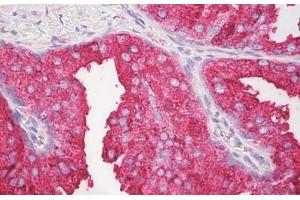 Image no. 2 for anti-Interleukin 27 (IL27) (C-Term) antibody (ABIN6749775) (IL-27 抗体  (C-Term))