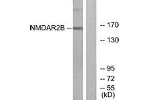 Western blot analysis of extracts from Jurkat cells, using NMDAR2B (Ab-1474) Antibody. (GRIN2B 抗体  (AA 1435-1484))