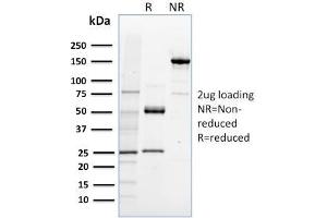 SDS-PAGE Analysis Purified NRF1 Mouse Monoclonal Antibody (NRF1/2608). (NFE2L1 抗体)
