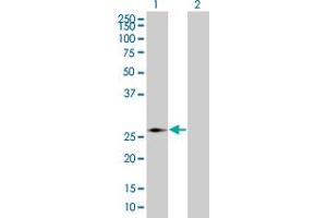 Western Blot analysis of PMM2 expression in transfected 293T cell line by PMM2 MaxPab polyclonal antibody. (PMM2 抗体  (AA 1-246))