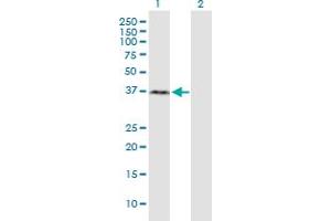 Western Blot analysis of RNF2 expression in transfected 293T cell line by RNF2 monoclonal antibody (M03), clone 3G6. (RNF2 抗体  (AA 192-290))
