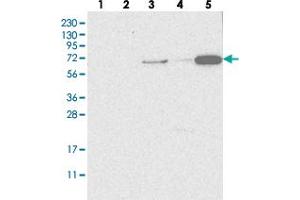Western blot analysis of Lane 1: RT-4, Lane 2: U-251 MG, Lane 3: Human Plasma, Lane 4: Liver, Lane 5: Tonsil with SH3TC2 polyclonal antibody . (SH3TC2 抗体)