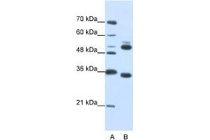 WB Suggested Anti-WDR6  Antibody Titration: 0. (WDR6 抗体  (C-Term))