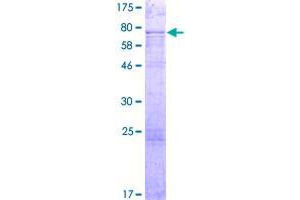 S100PBP Protein (AA 1-408) (GST tag)