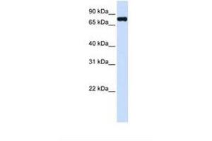 Image no. 1 for anti-Zinc Finger, FYVE Domain Containing 1 (ZFYVE1) (AA 650-699) antibody (ABIN6749748) (ZFYVE1 抗体  (AA 650-699))