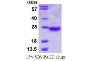 SDS-PAGE (SDS) image for MAD2 Mitotic Arrest Deficient-Like 1 (Yeast) (MAD2L1) (AA 1-205) protein (His tag) (ABIN6386805) (MAD2L1 Protein (AA 1-205) (His tag))