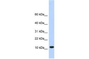 Western Blotting (WB) image for anti-Chromosome 10 Open Reading Frame 57 (C10ORF57) antibody (ABIN2459344) (CJ057 抗体)
